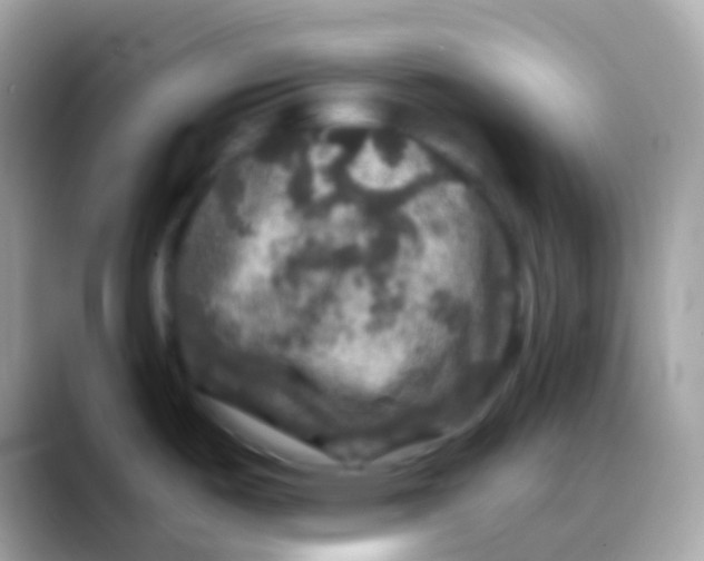 X0000088141487200706041328