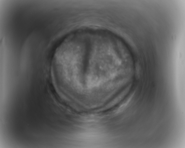 X0000088141494200706041327