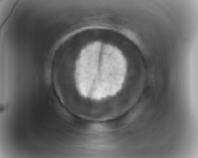 X0000088141504200706041328