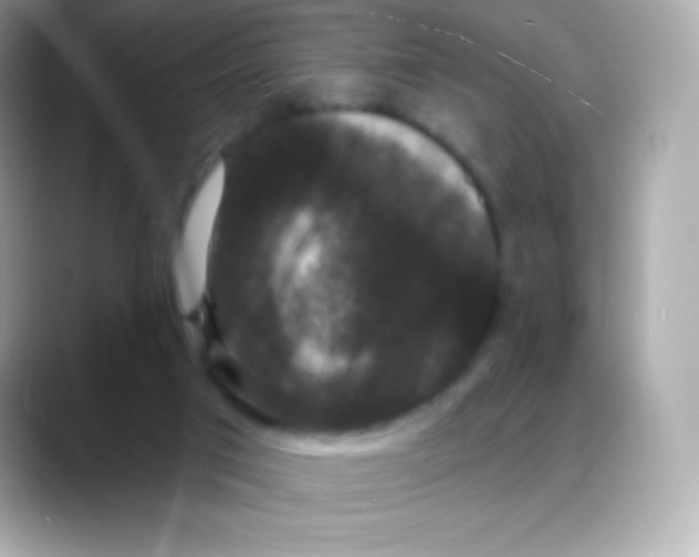 X0000088140017200706042018