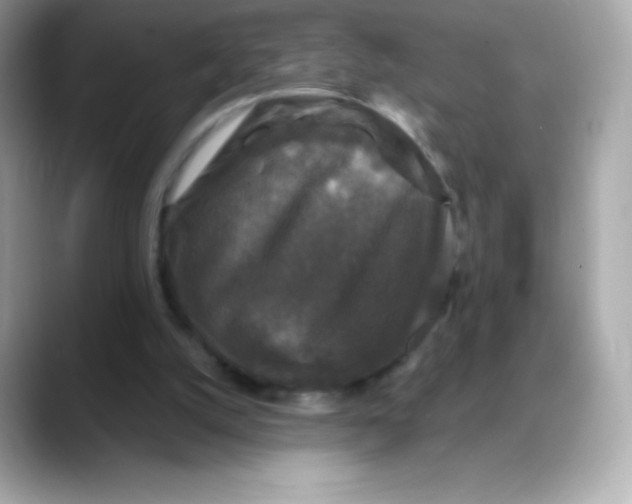 X0000088140056200706042017