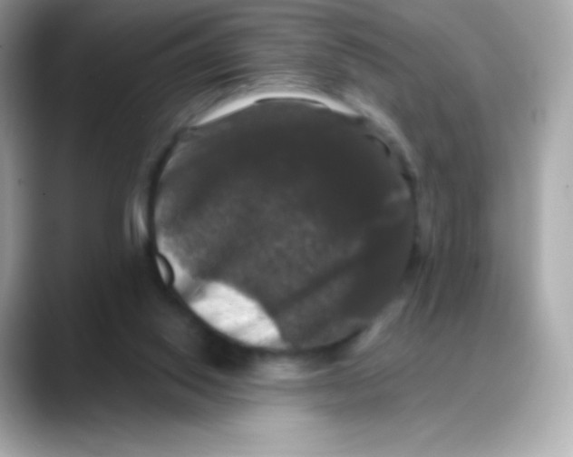 X0000088140062200706042017