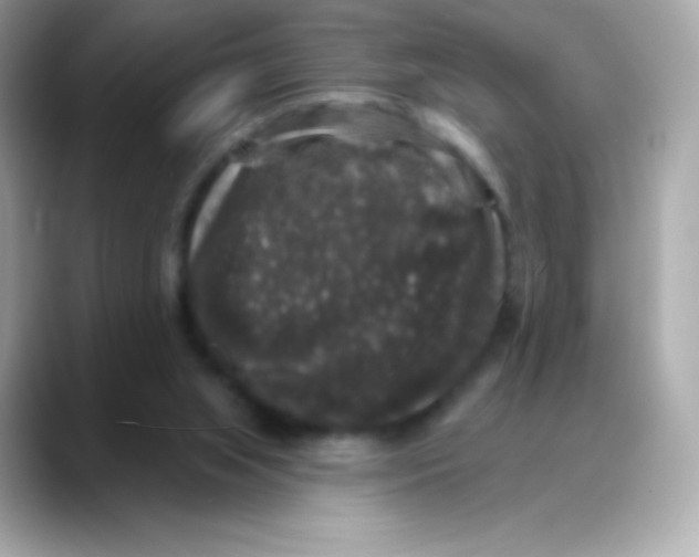 X0000088140063200706042017