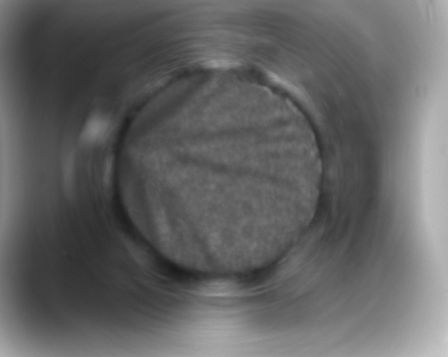 X0000088140066200706042017