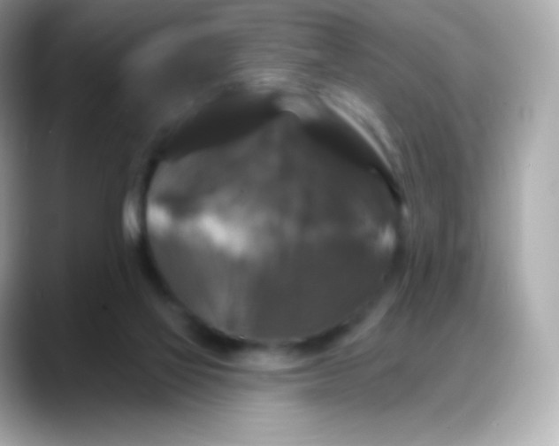 X0000088140069200706042017