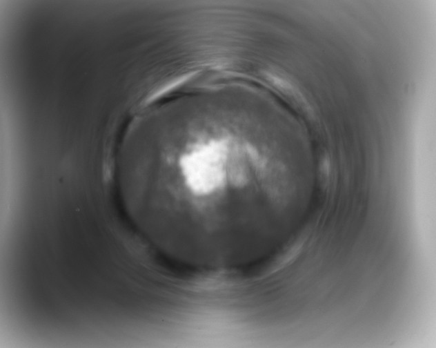 X0000088140072200706042017