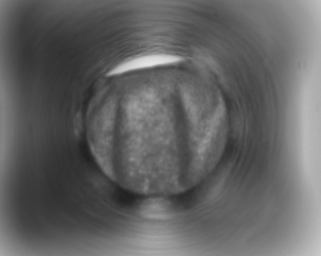 X0000088140077200706042017