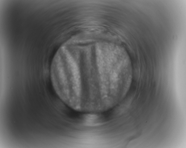 X0000088140085200706042017