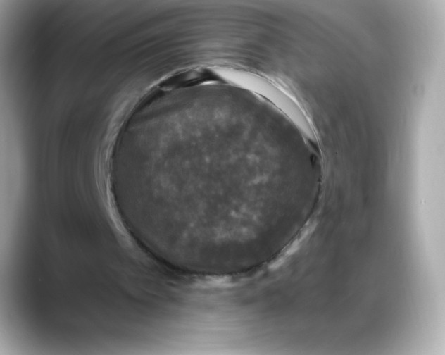 X0000088140097200706042017