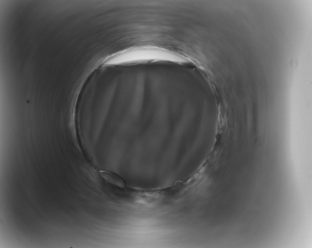 X0000088140099200706042017