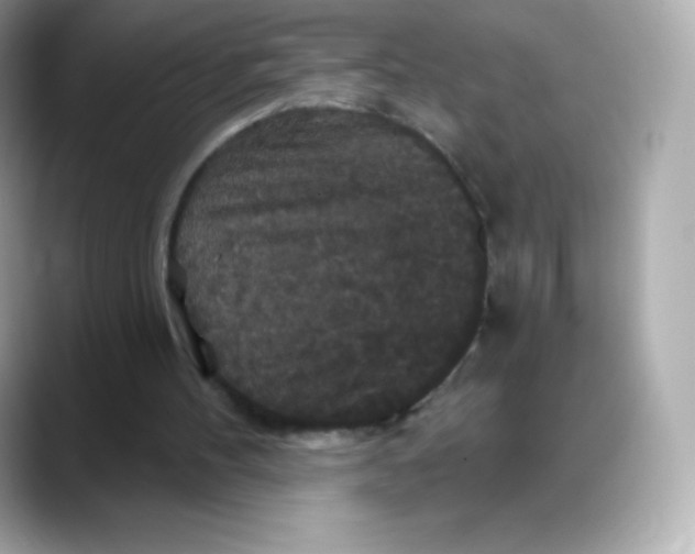 X0000088140100200706042017