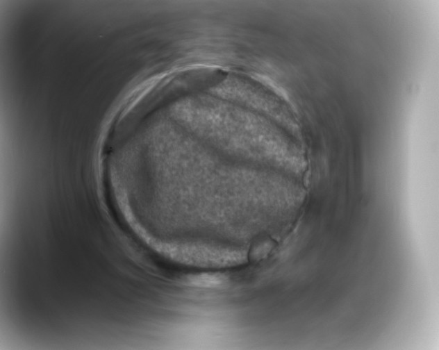 X0000088140102200706042017