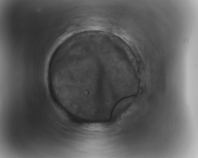 X0000088140104200706042017