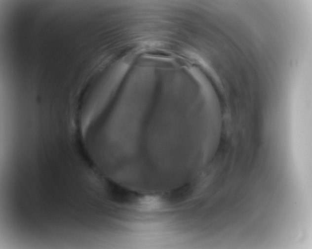 X0000088140114200706042017