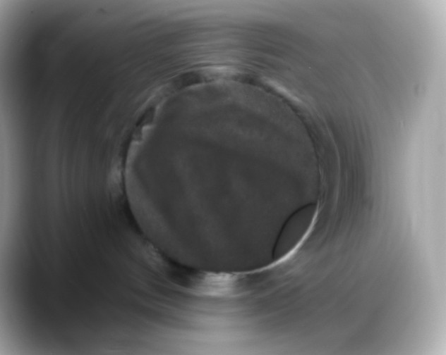 X0000088140144200706042016