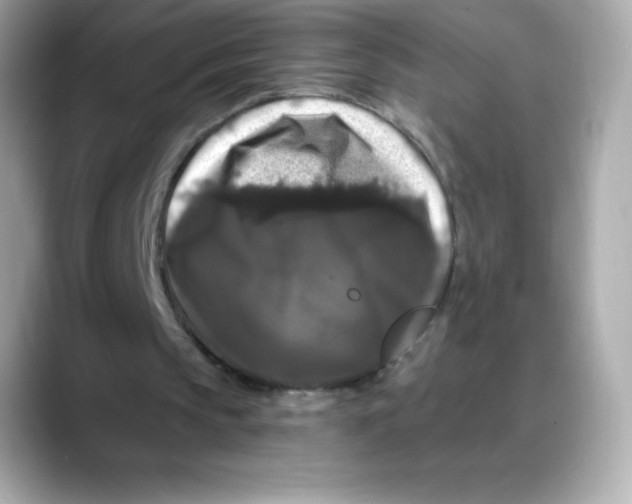 X0000088140145200706042016