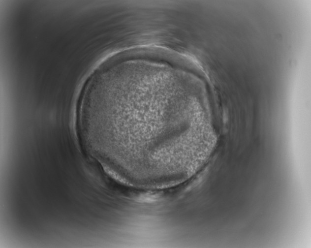 X0000088140148200706042016