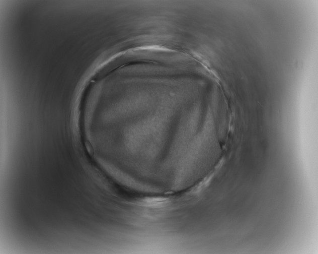 X0000088140150200706042016