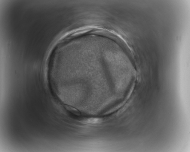 X0000088140152200706042016