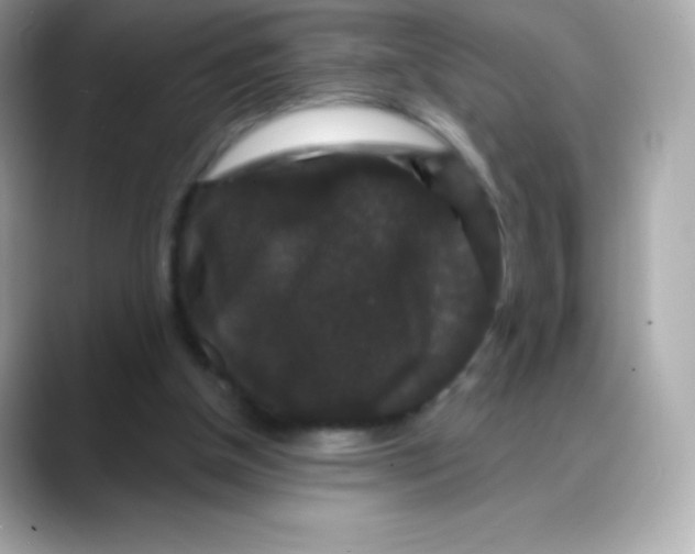 X0000088140154200706042016