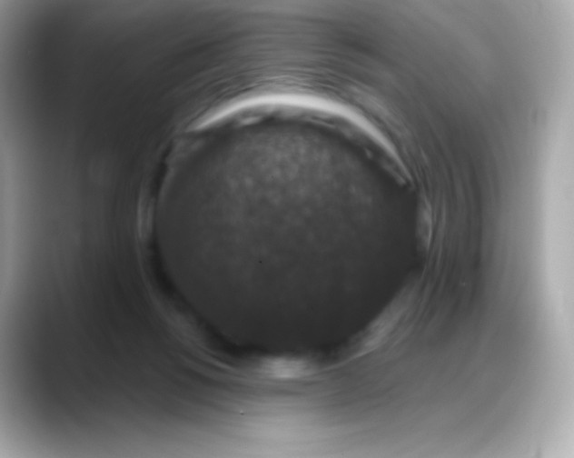 X0000088140168200706042016