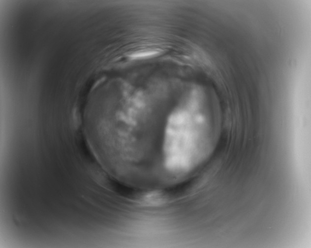 X0000088140173200706042016