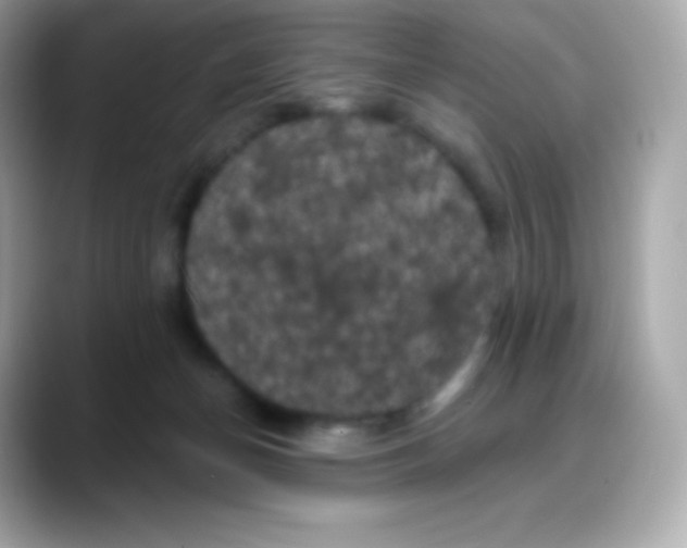 X0000088140174200706042016