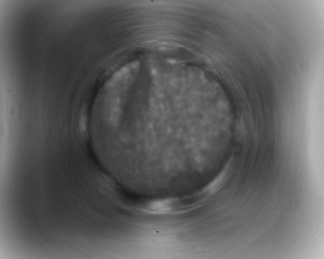 X0000088140178200706042016