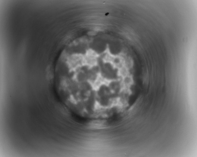 X0000088140179200706042016