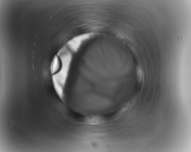 X0000088140181200706042016