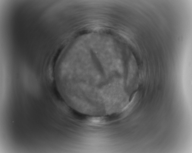 X0000088140187200706042016