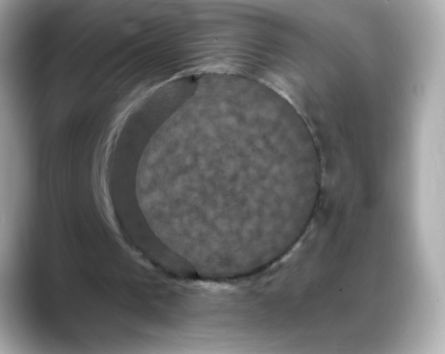 X0000088140193200706042016