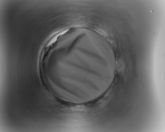 X0000088140196200706042016