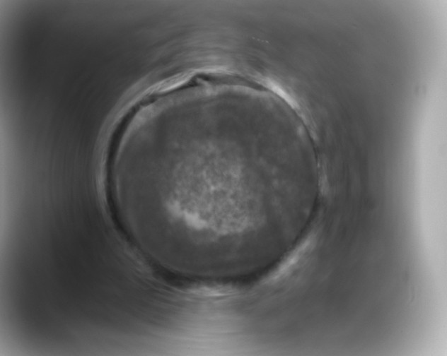 X0000088140199200706042016