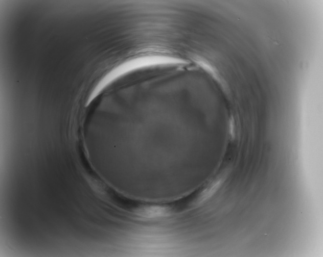 X0000088140205200706042015