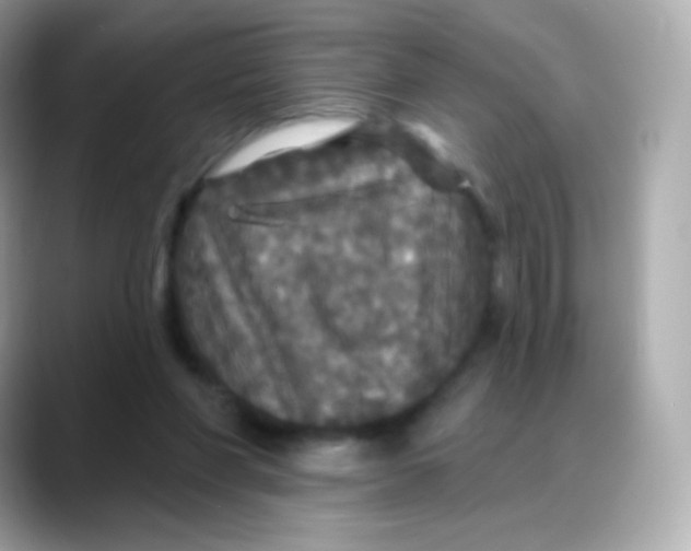 X0000088140206200706042015