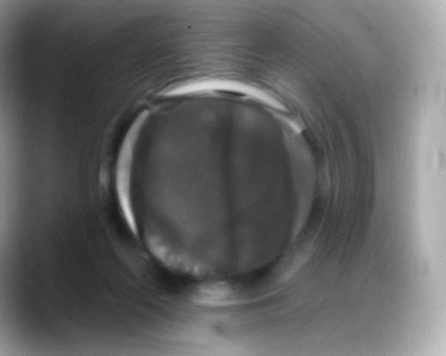 X0000088140214200706042015