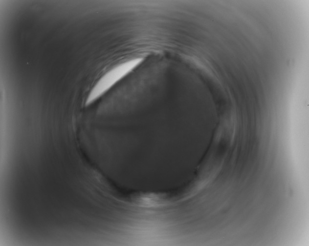 X0000088140229200706042015