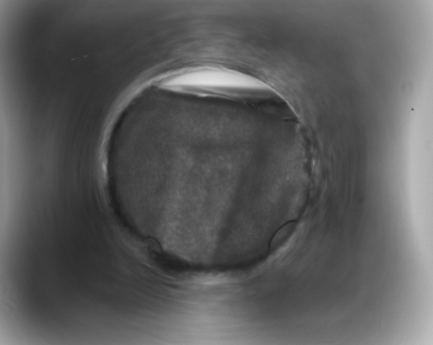 X0000088140246200706042014