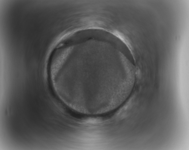 X0000088140248200706042015