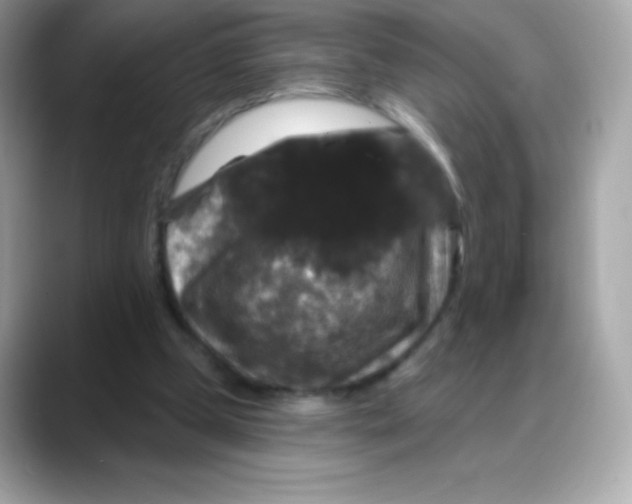 X0000088140249200706042015