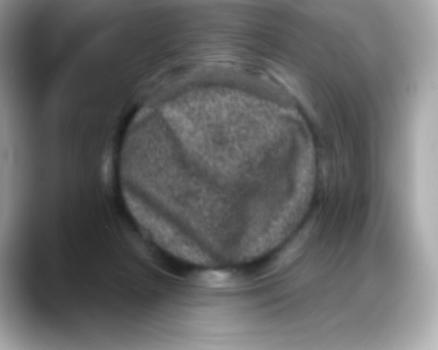 X0000088140265200706042015