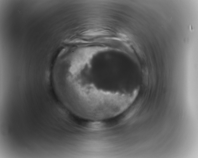 X0000088140269200706042015