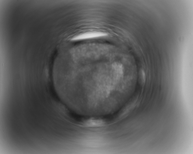 X0000088140270200706042015