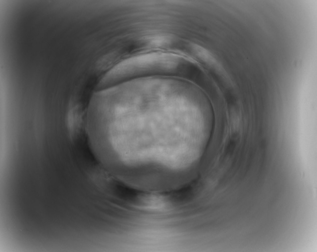 X0000088140276200706042015