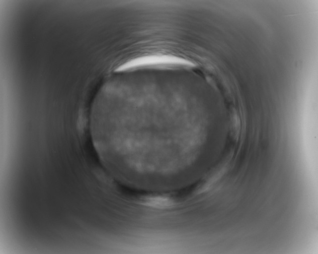 X0000088140284200706042015