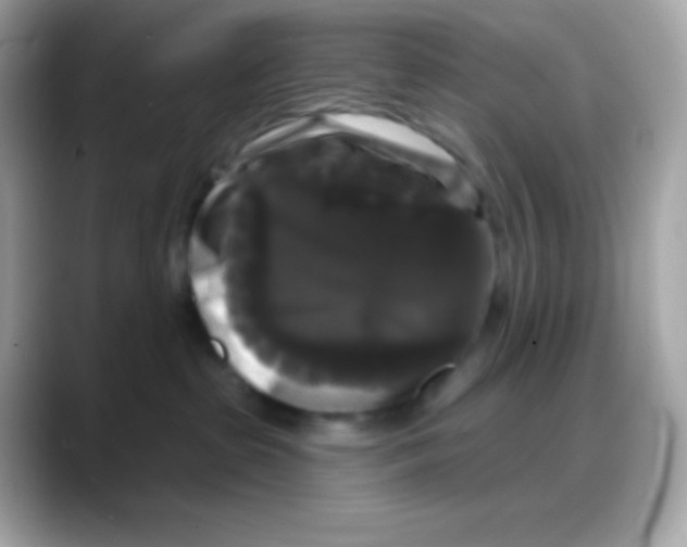 X0000088140285200706042015