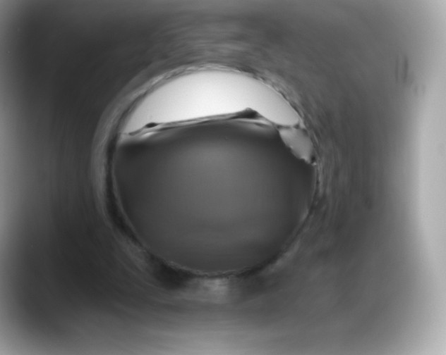 X0000088140295200706042014