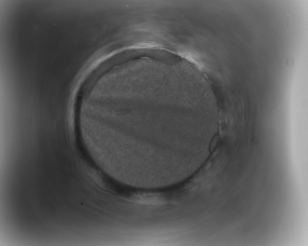 X0000088140296200706042014