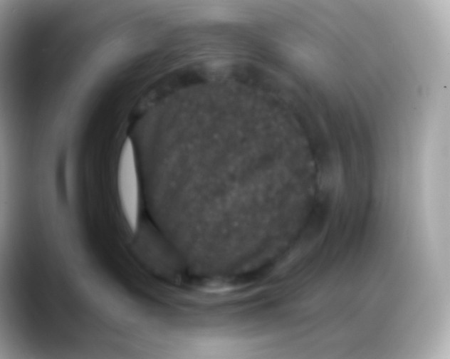 X0000088140335200706042014